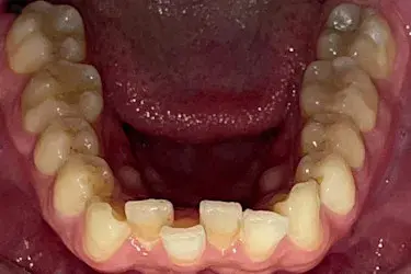 Before Image