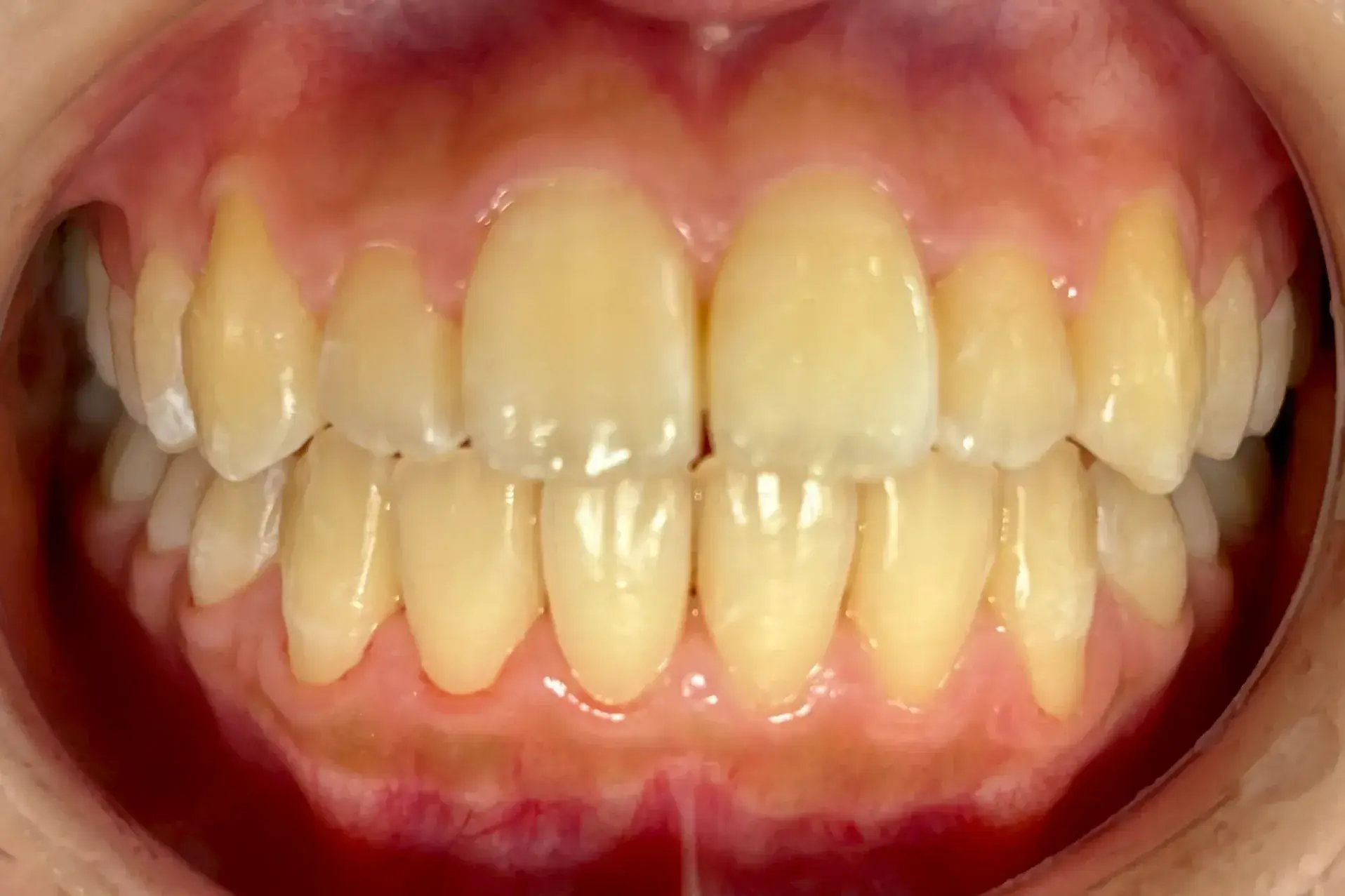 After Image
