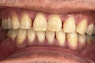 Before Image