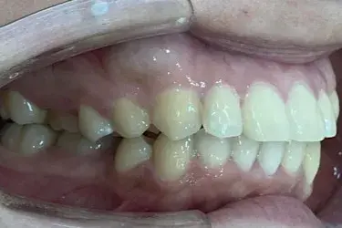 After Image