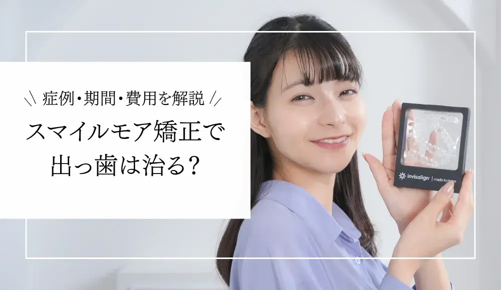 【歯科医師監修】スマイルモア矯正で出っ歯は治る？軽度から重度の症例・費用・期間を解説