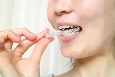 過蓋咬合の芸能人は？過蓋咬合を治す方法や放置するリスクなど徹底解説！