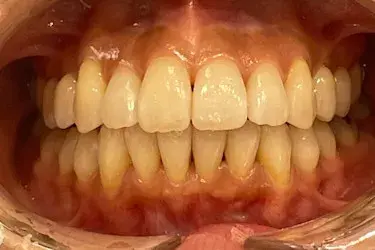 After Image