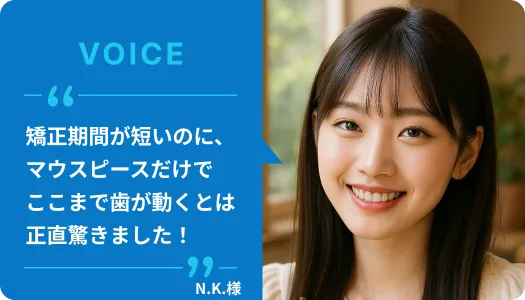 こんなに短期間で矯正が終わると思わず、びっくりしました｜21歳の女子大生N.K.様