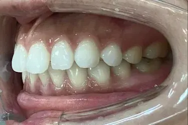 Before Image