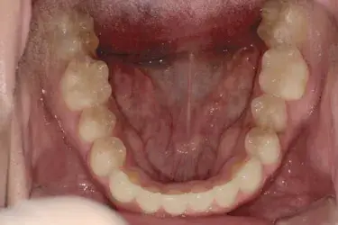 After Image