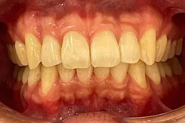 After Image