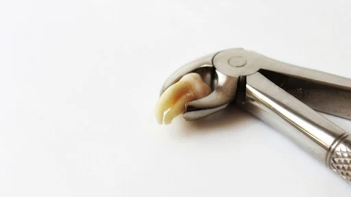 口元が引っ込みすぎた！？【抜歯矯正】失敗しないための予防法を解説