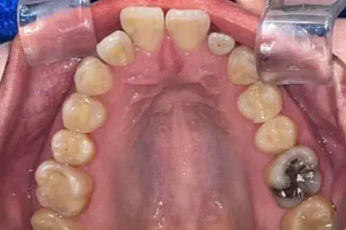Before Image
