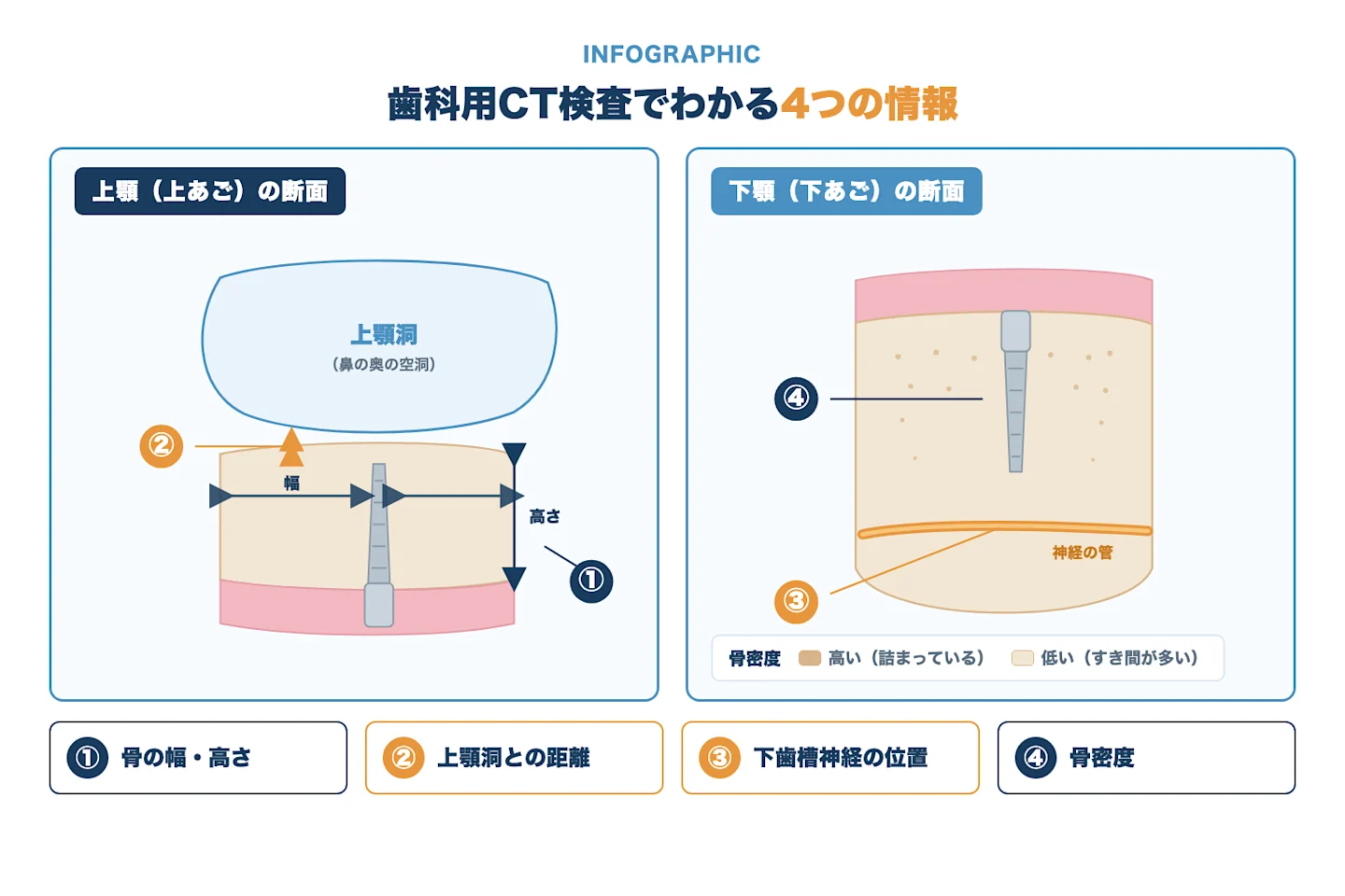 歯科用CT検査でわかる4つの情報を示した顎骨の断面図