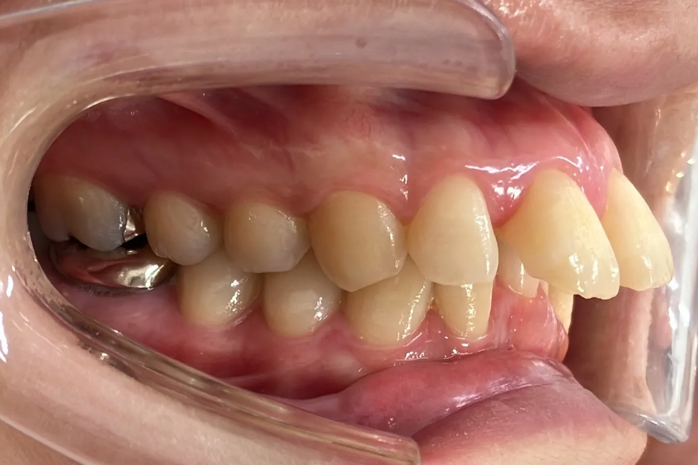 Before Image