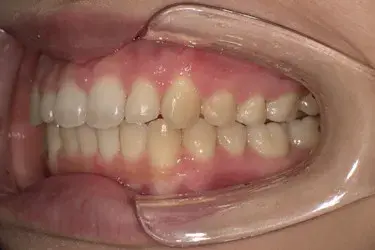 After Image