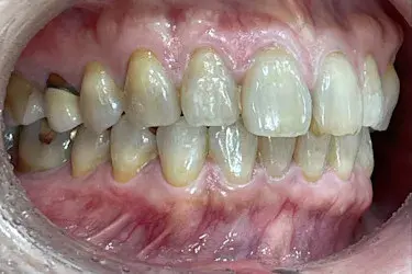 After Image