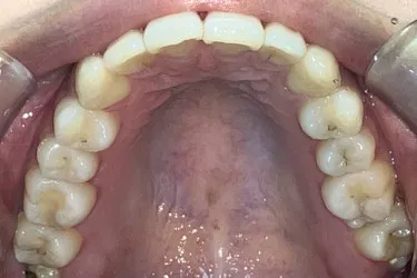 After Image