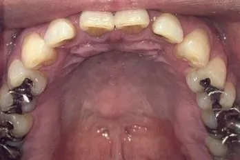 Before Image