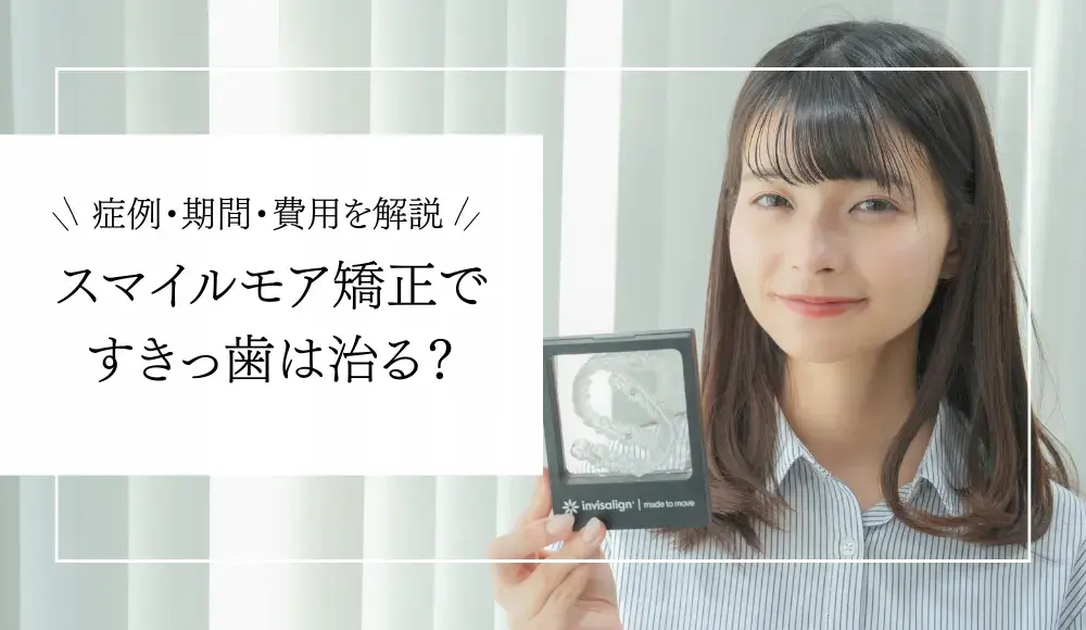 スマイルモア矯正ですきっ歯はどこまで治る？費用・期間から実際の症例まで徹底解説