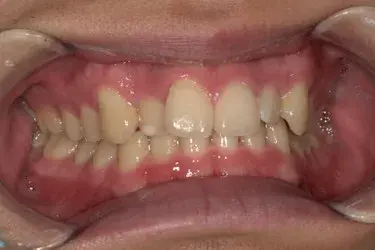 Before Image