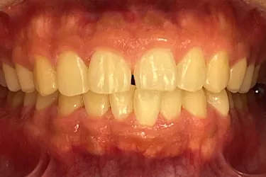 Before Image