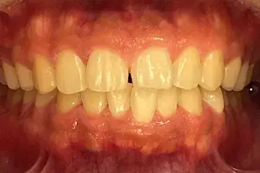 Before Image