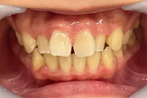 Before Image