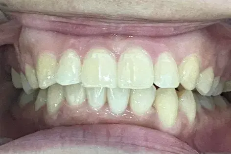 After Image