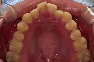 Before Image