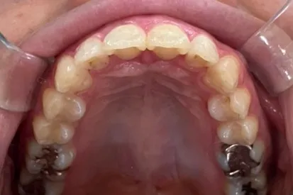After Image