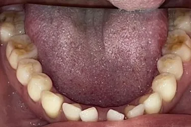Before Image