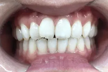 Before Image