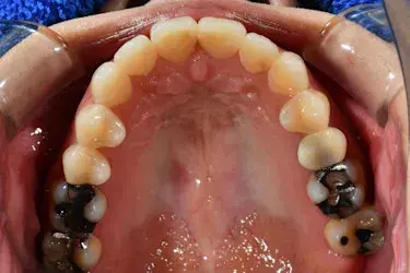 After Image