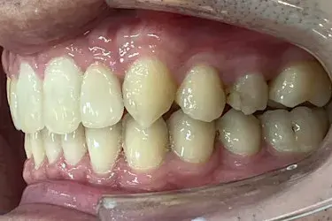 After Image
