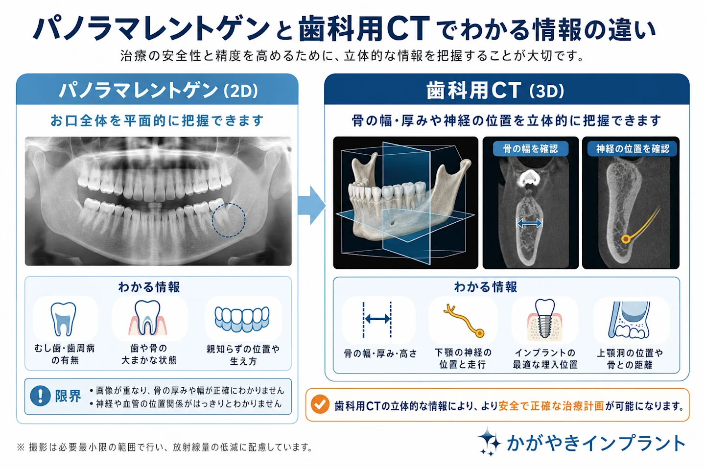 パノラマレントゲンと歯科用CTでわかる情報の違いを比較した図