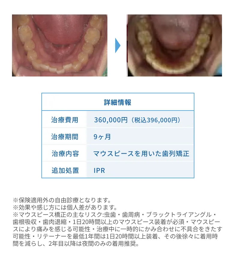 S.Y.様の治療内容