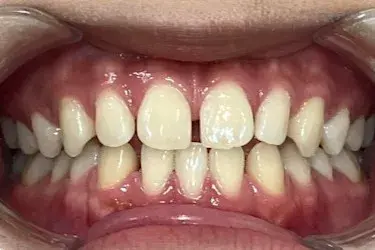 Before Image