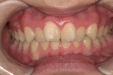 Before Image