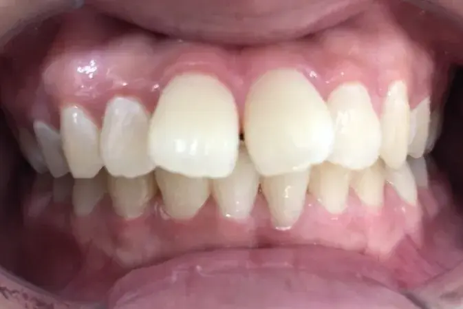 Before Image