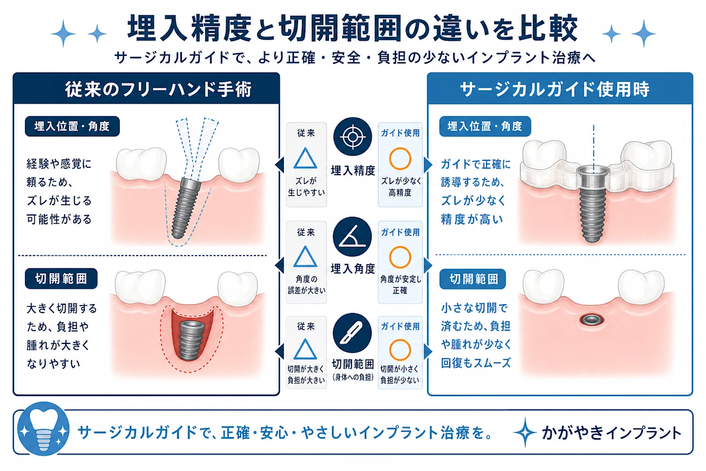 フリーハンド手術とサージカルガイド使用時の埋入精度・切開範囲の比較図