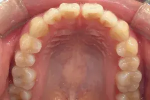 Before Image