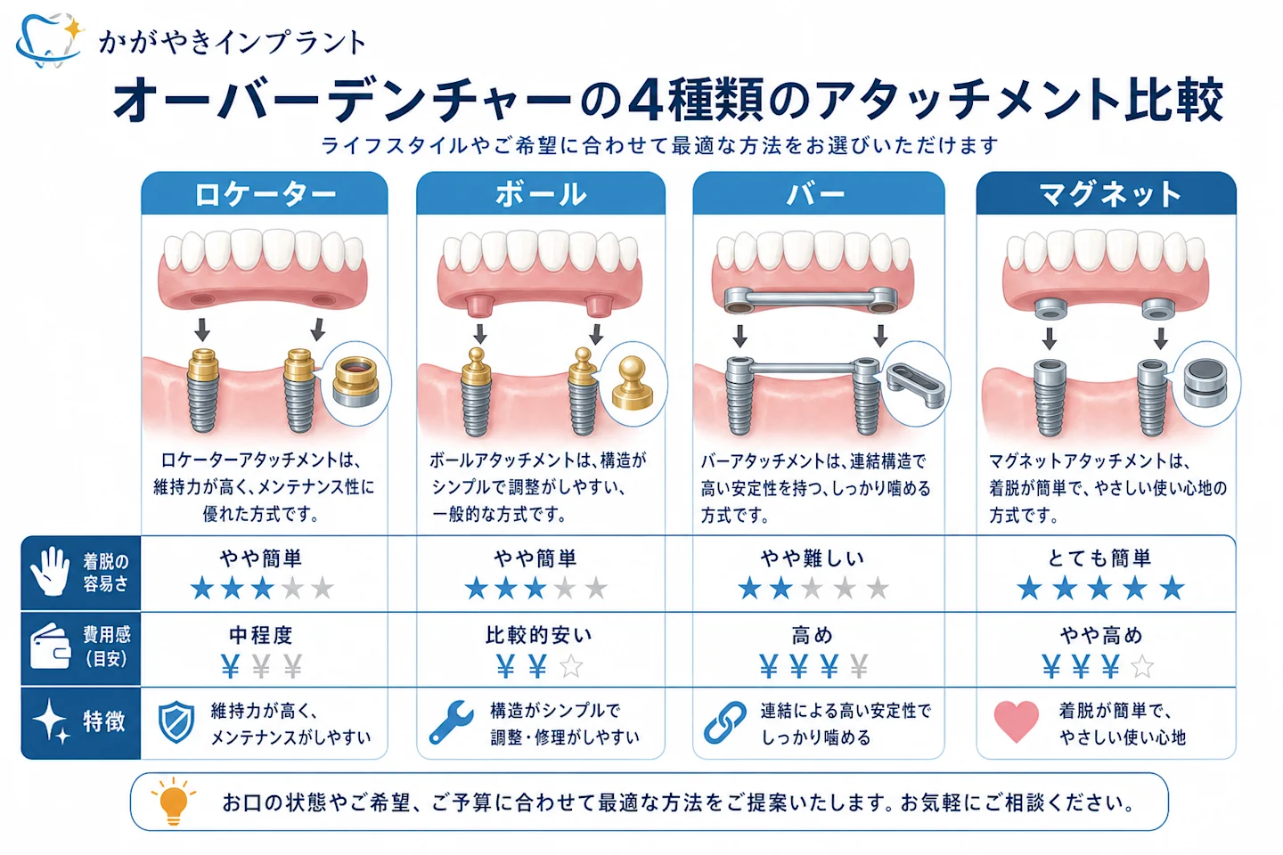 オーバーデンチャーの4種類のアタッチメント(ロケーター・ボール・バー・マグネット)比較図