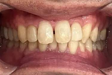 Before Image