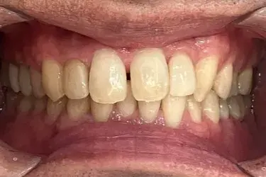 Before Image