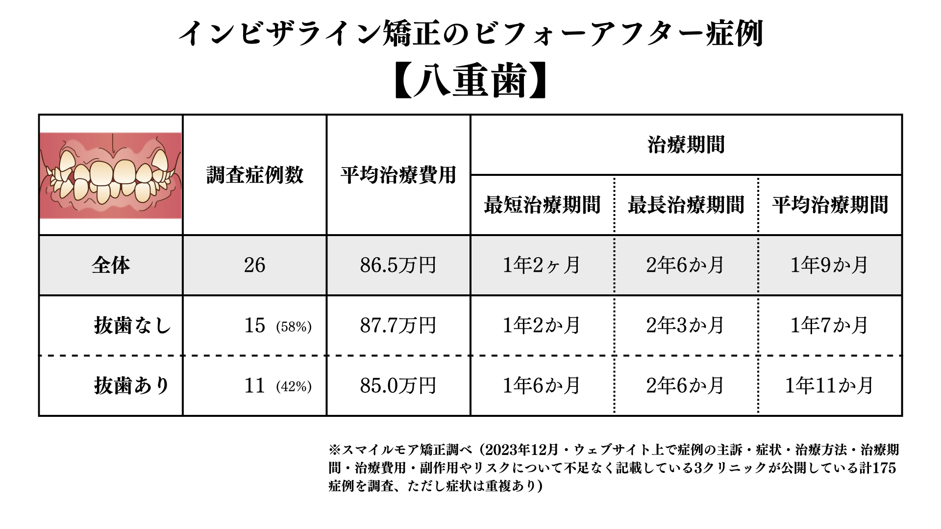 インビザライン矯正の八重歯のビフォアーアフター症例調査結果