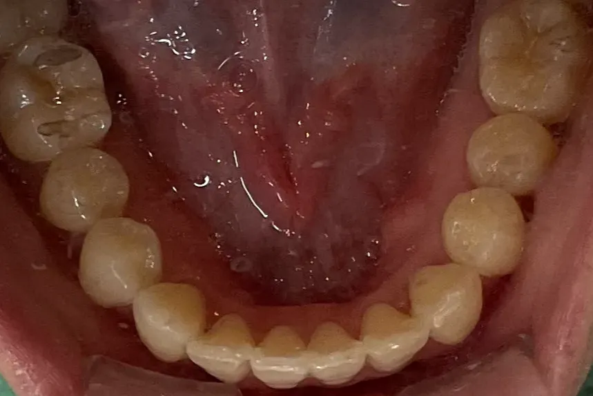 After Image