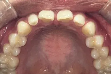 Before Image