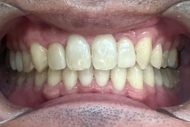 After Image