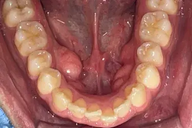 Before Image