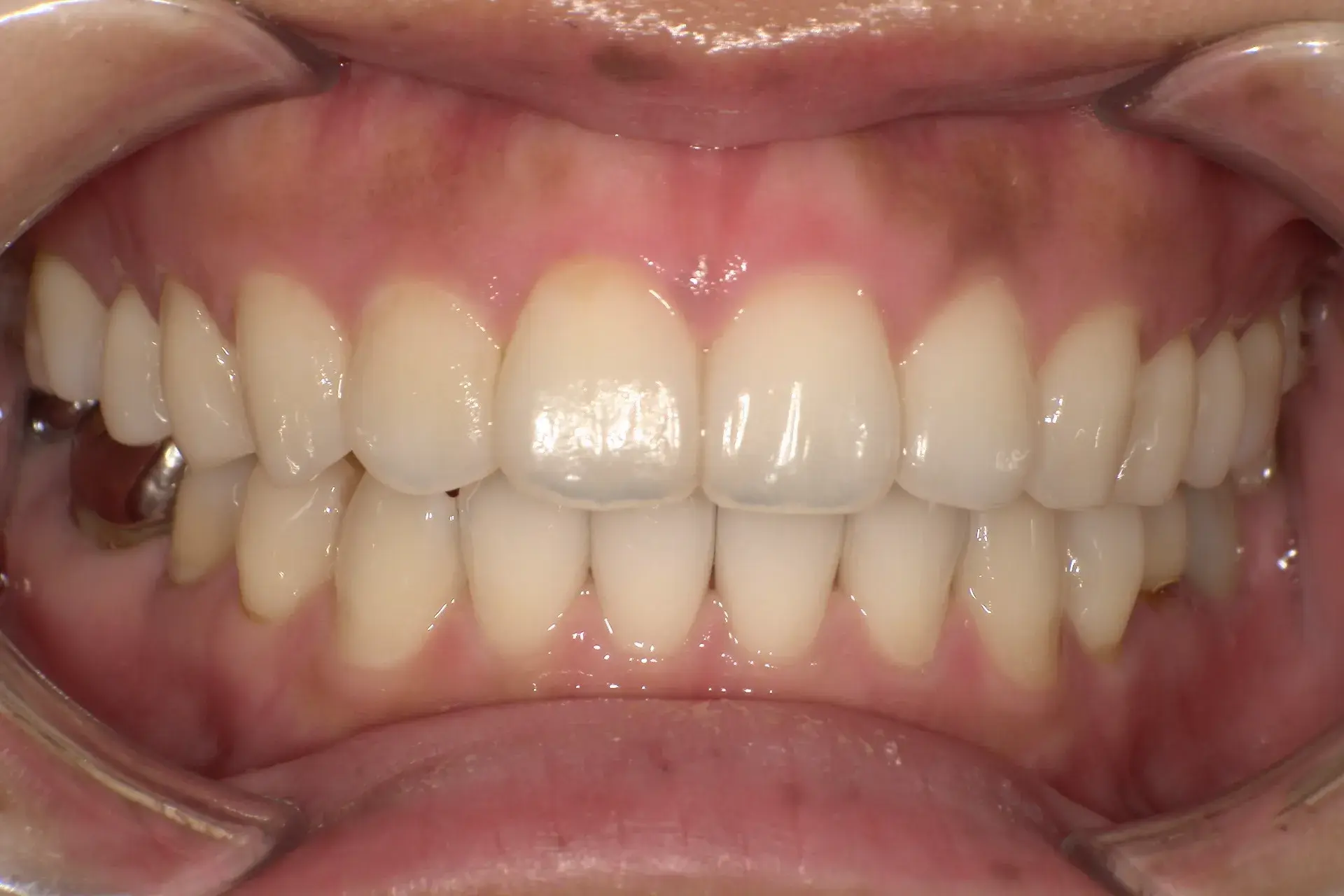 After Image