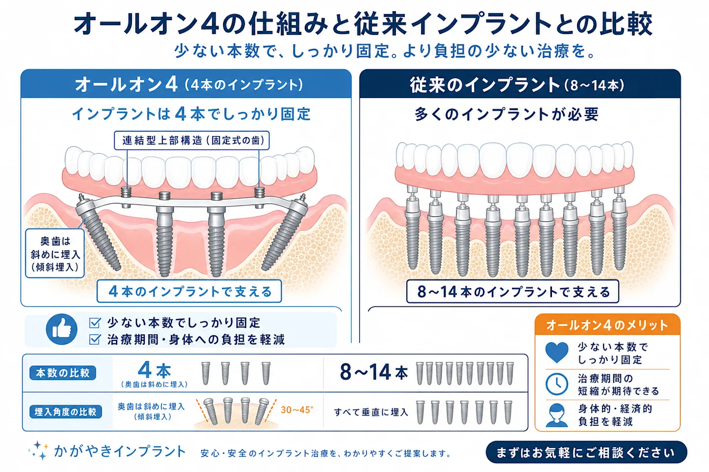 All-on-4の仕組みと従来インプラント（8〜14本）との本数・埋入角度の比較図