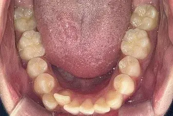 Before Image
