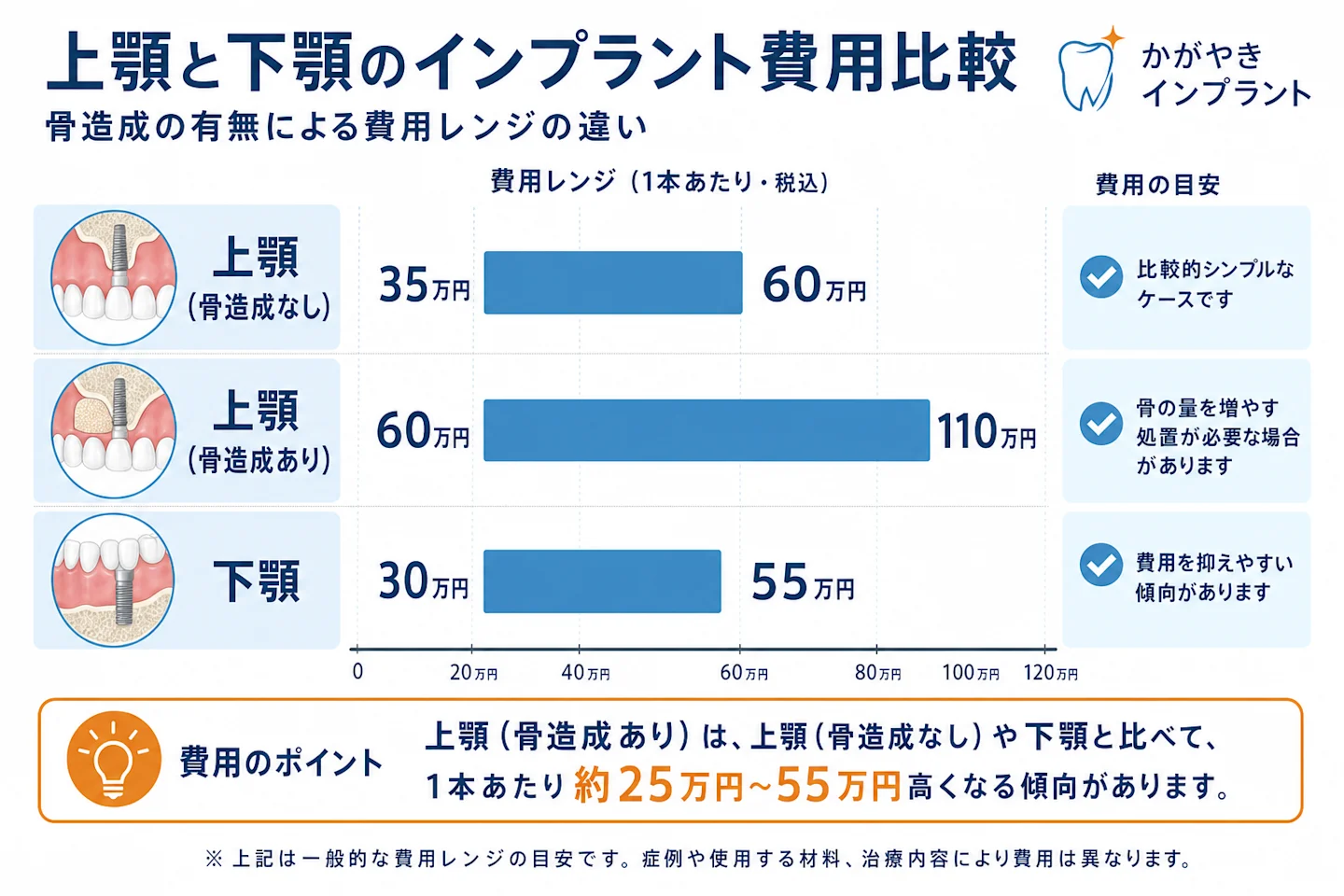 上顎と下顎のインプラント費用差を骨造成の有無別に比較したグラフ